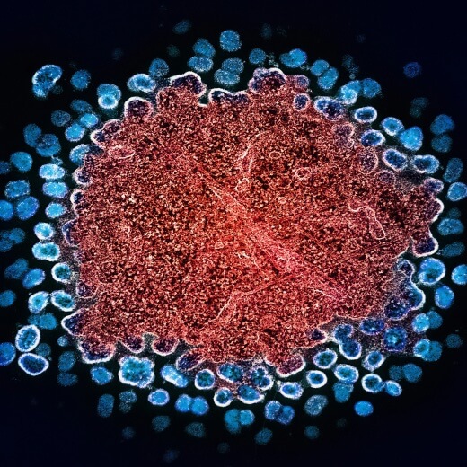 Colorized illustration of a cytomegalovirus particle surrounded by smaller viral particles.