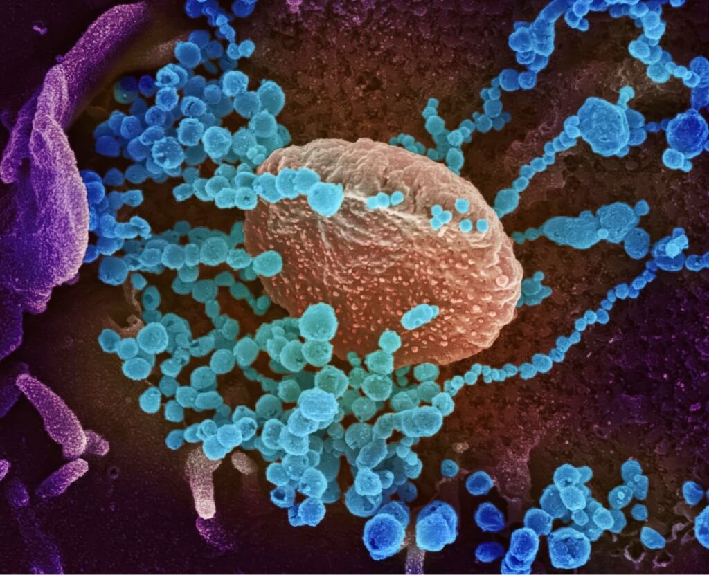 Colorized microscopy image of virus particles surrounding a cell.